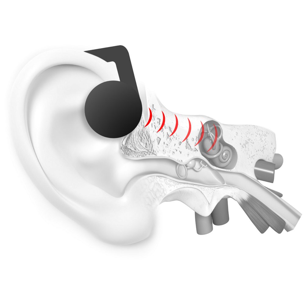 Air Conduction Open Ear | Best Sport Headphones 
